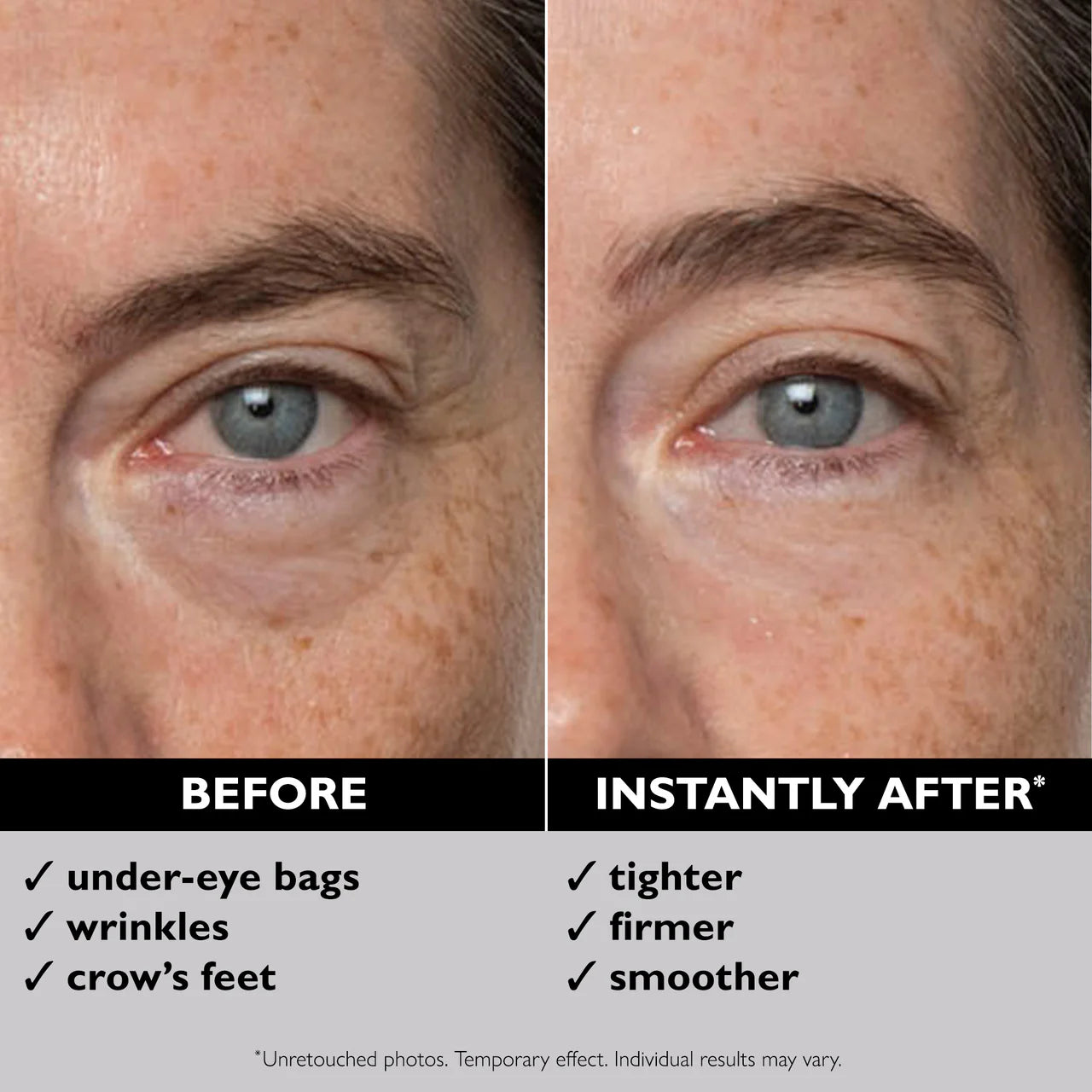 Instant FIRMx Eye Tightener for Puffiness, Fine Lines & Under Eye Bags