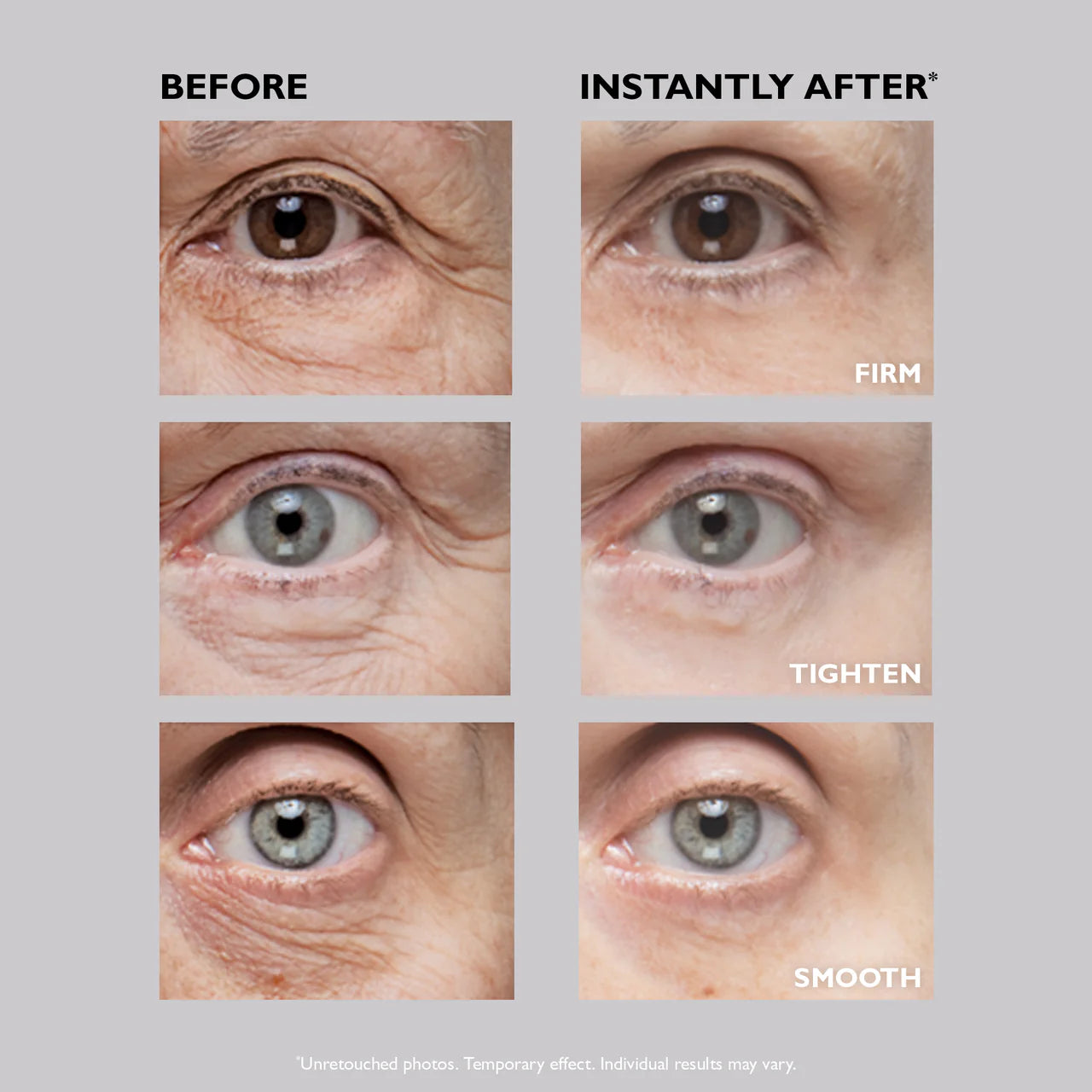 Instant FIRMx Eye Tightener for Puffiness, Fine Lines & Under Eye Bags