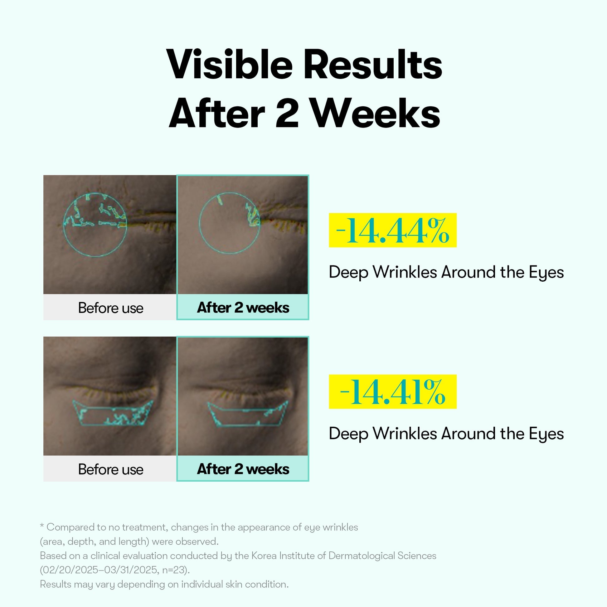 PDRN Reedle Shot Firming Eye Cream with Collagen for Dark Circles and Puffiness