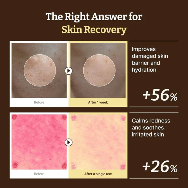 Advanced PDRN Rejuvenating Cream Korean Skincare with Collagen for Elasticity and Wrinkles