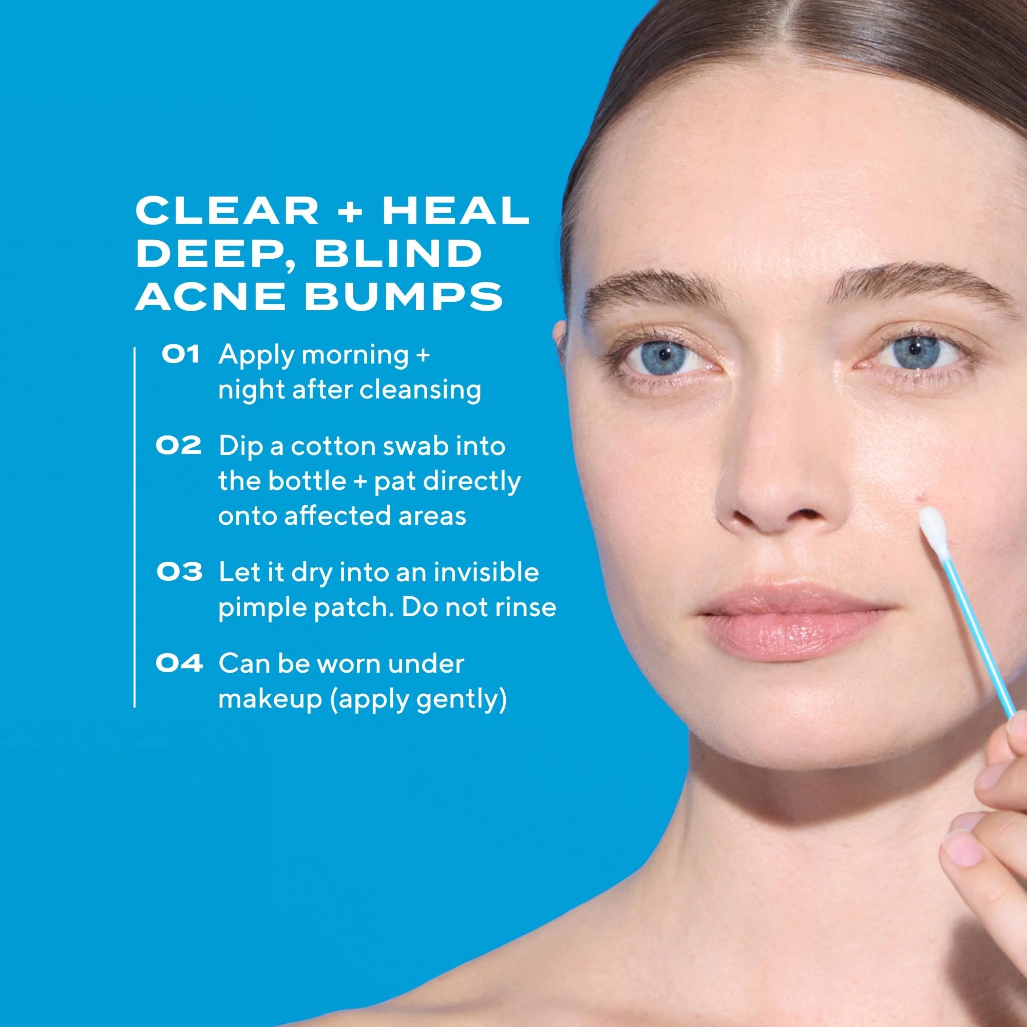 Deep Relief Acne Care for Breakouts, Blemishes & Oily Skin