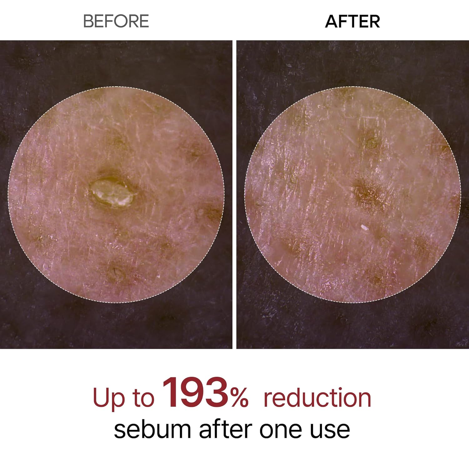 Peel Shot Glow Rice Ampoule Duo with Niacinamide and BHA for Pores and Uneven Skin Tone