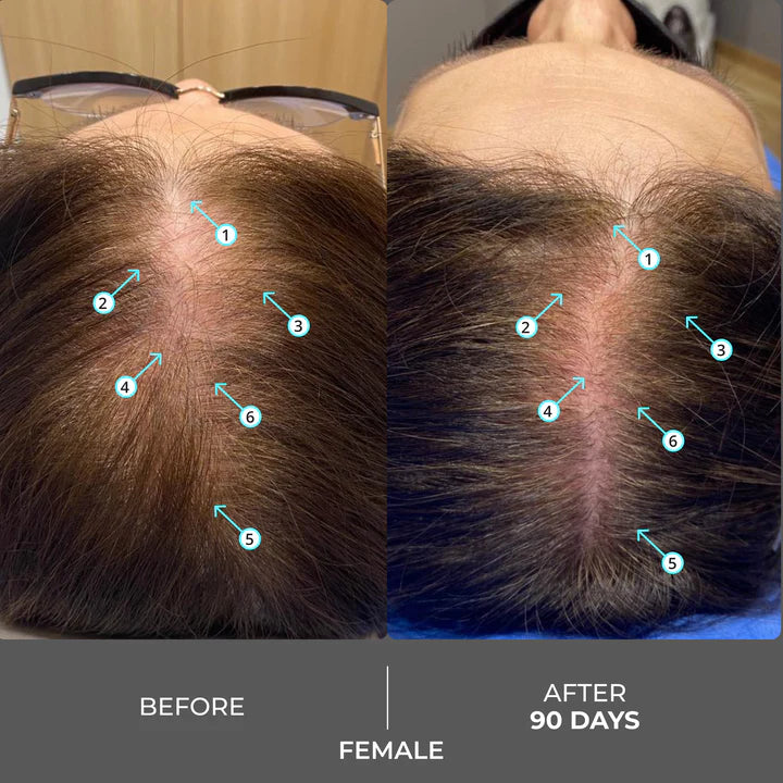 Extra Strength Hair DENSITY Shampoo for Thicker, Fuller-Looking Hair & Scalp Care