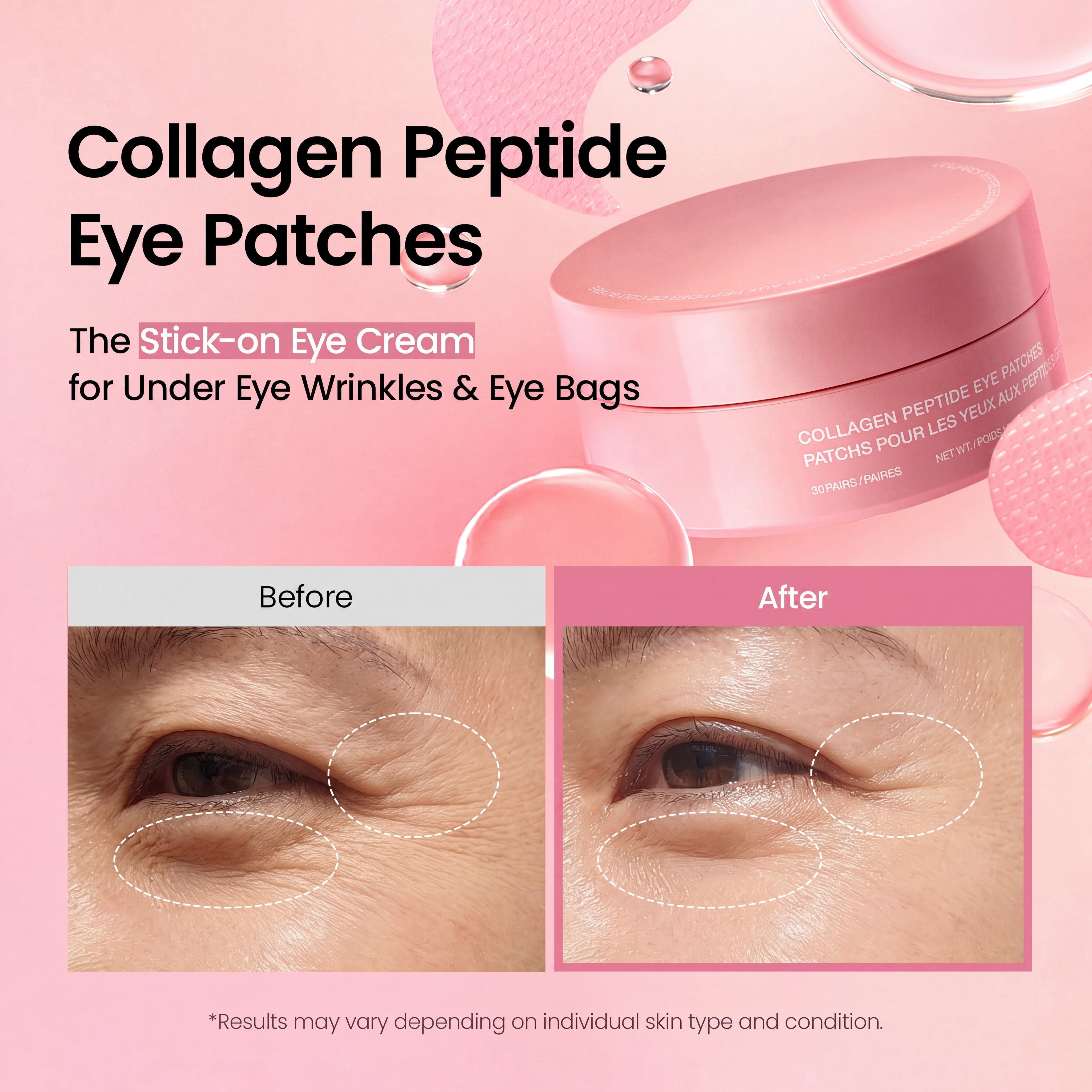 Collagen Peptide Eye Patches with Caffeine for Under Eye Bags and Puffiness
