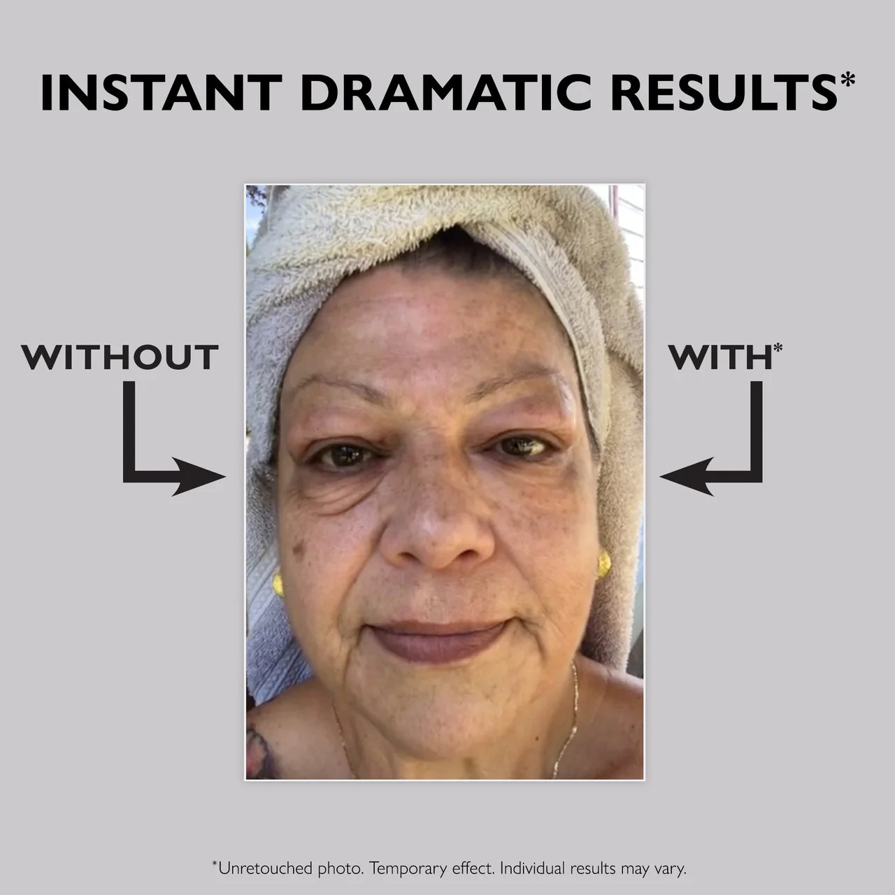 Instant FIRMx Eye Tightener for Puffiness, Fine Lines & Under Eye Bags