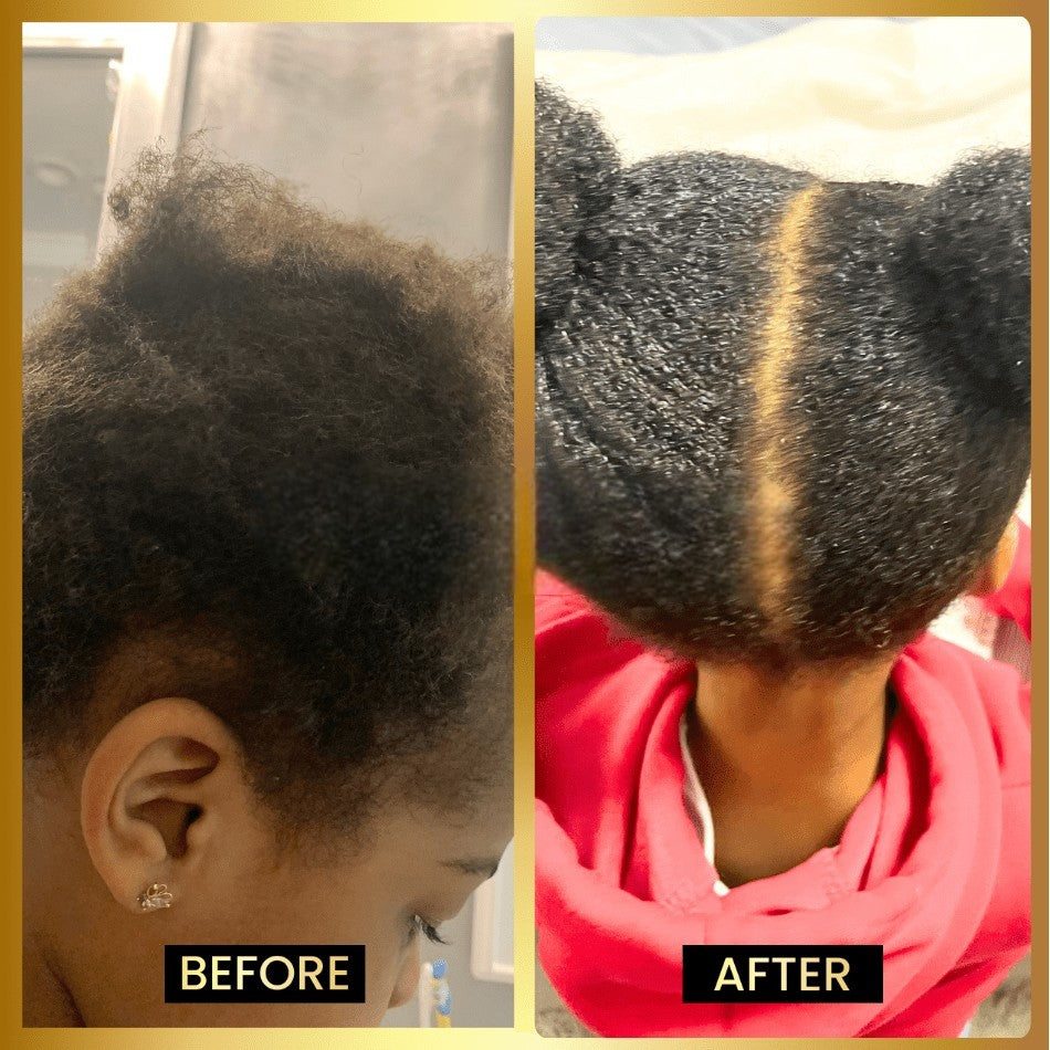 Stimulating Scalp & Hair Balm for Dry Scalp, Frizz, Moisture & Healthy Hair