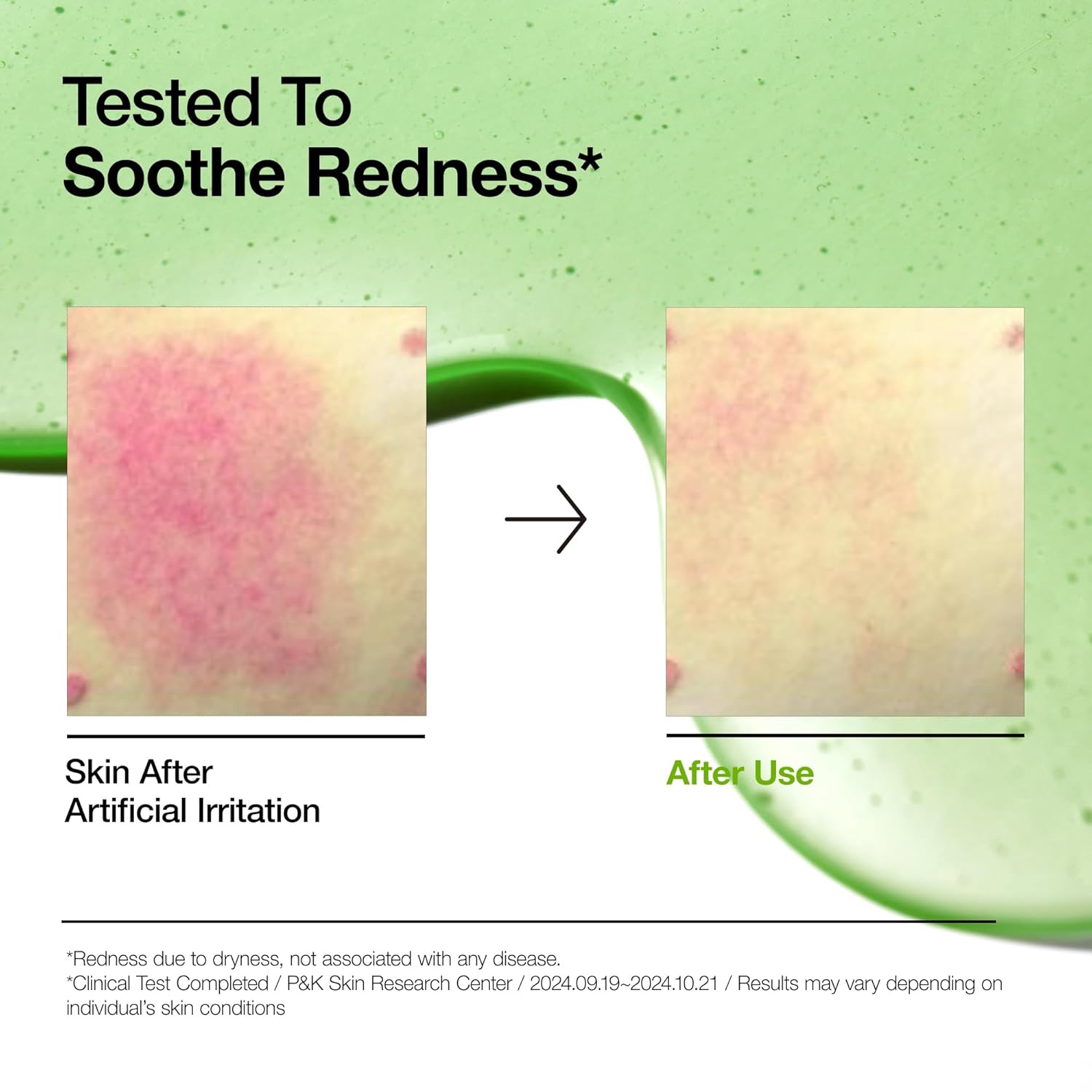 Azelaic Acid 10% Serum with Hyaluronic Acid for Redness & Uneven Skin Tone