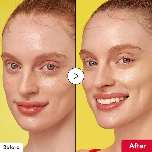 Vitamin Illuminating Serum with Niacinamide for Dark Spots